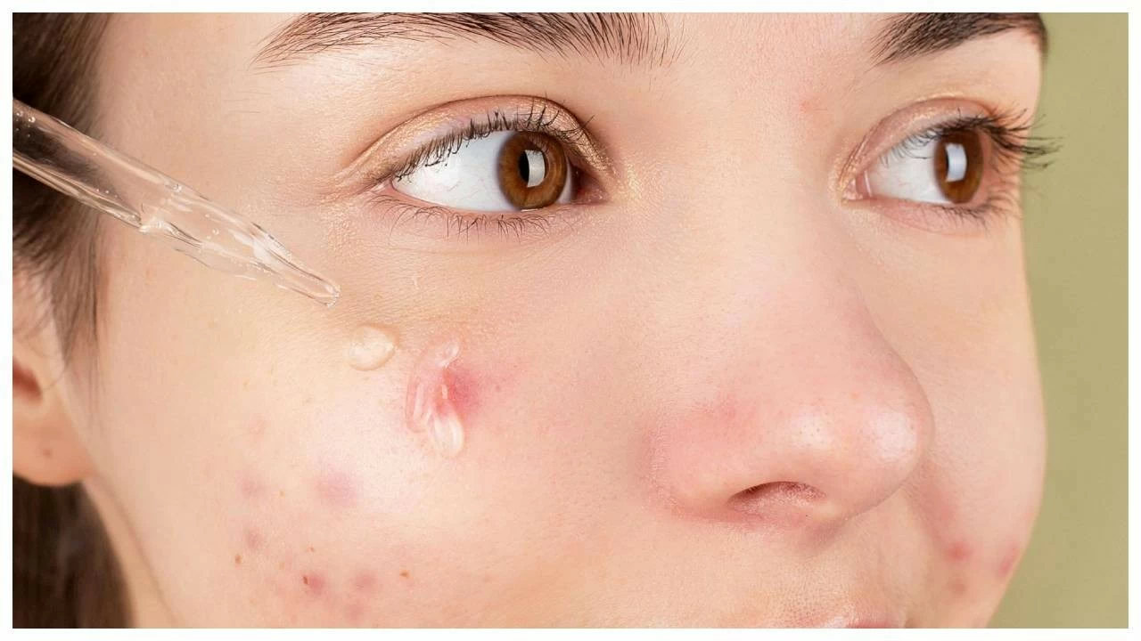 Pollution also damages the barrier of the skin, thus making it more sensitive.