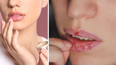 Never worry about dry, flaky lips again with these pro tricks

