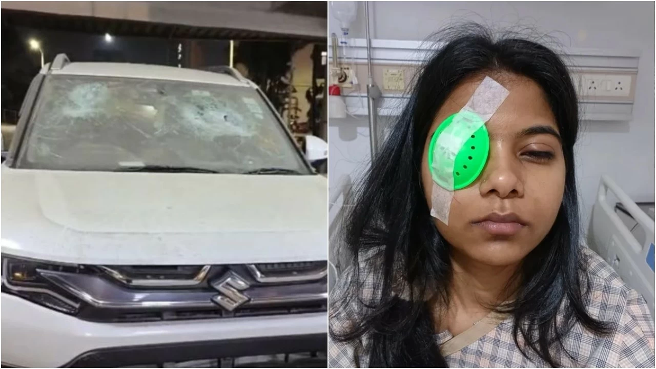 The 28-year-old woman, an HR executive from Chembur, suffered a serious injury to her left eye after the car she was travelling in was chased and attacked by three men riding a two-wheeler. (Photo: X)