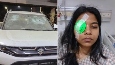 The 28-year-old woman, an HR executive from Chembur, suffered a serious injury to her left eye after the car she was travelling in was chased and attacked by three men riding a two-wheeler. (Photo: X)