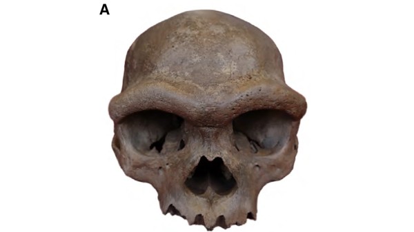 skull