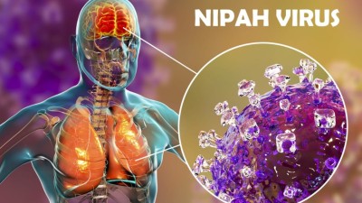 West Bengal health department heightens Nipah Surveillance