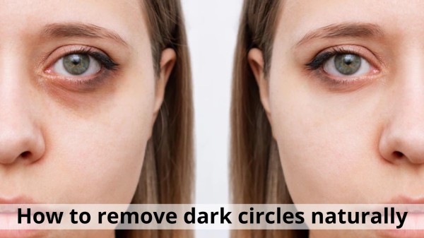 Dark circles ruining your look? Try these home remedies today