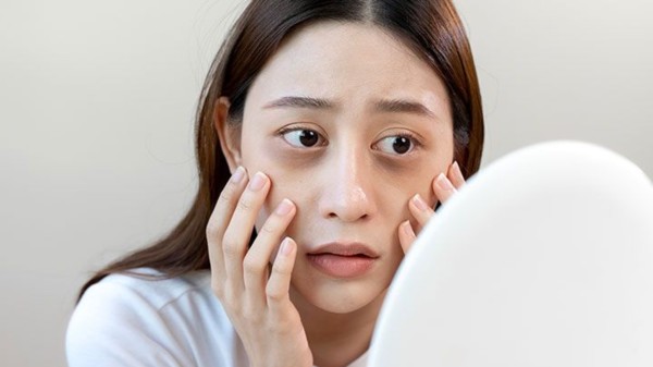 How_to_remove_dark_circles_naturally_(1)